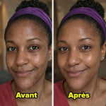 Load image into Gallery viewer, DR.MELAXIN Peel Shot Duo- Ampoule exfoliante au riz noir Shot