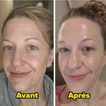 Load image into Gallery viewer, DR.MELAXIN Peel Shot Duo- Ampoule exfoliante au riz noir Shot
