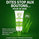 Load image into Gallery viewer, 🌿 Crème Anti-Acné Aloe – Dites Adieu aux Boutons, Taches &amp; Points Noirs En 7 Jours BN
