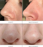 Load image into Gallery viewer, DR.MELAXIN Peel Shot Duo- Ampoule exfoliante au riz noir Shot
