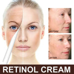Load image into Gallery viewer, EELHOE Retinol Face Cream – Anti-Rides
