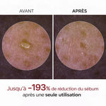 Load image into Gallery viewer, DR.MELAXIN Peel Shot Duo- Ampoule exfoliante au riz noir Shot

